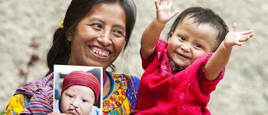 Operación Sonrisa anuncia una nueva colecta nacional para ayudar a los niños a nivel nacional. Operación Sonrisa Perú: ¿Cómo donar de manera segura en la nueva colecta para los infantes?