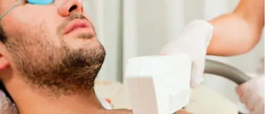 depilación láser Depilación láser para hombres: Conoce las ventajas de realizar este procedimiento