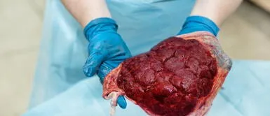 Perú: venden smoothie de placenta y se enciende la polémica en redes sociales Perú: venden smoothie de PLACENTA a 'millonario monto' y se enciende la polémica en redes sociales