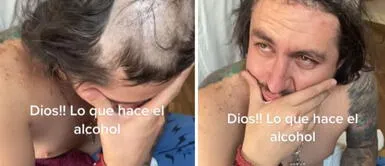 Padre se queda dormido borracho y sus hijos lo castigan rapándole el cabello Padre se queda dormido borracho y sus hijos lo 'castigan' rapándole el cabello