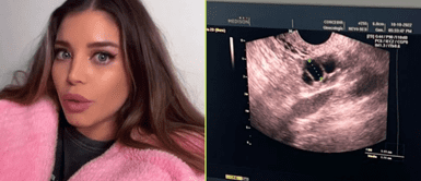 Flavia Laos contó detalles de su proceso de ovulación de óvulos. Flavia Laos congela sus óvulos para ser mamá luego de los 30: "No quiero que me juegue el reloj biológico en contra"