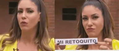 Tilsa Lozano confiesa que utiliza bótox. Foto: captura de América TV Tilsa Lozano revela cuáles son los ‘retoquitos’ estéticos a los que se ha sometido