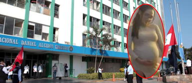 Callao: mujer llegó caminando a hospital para dar a luz, le hacen cesárea y fallece por infección Callao: mujer llegó caminando a hospital para dar a luz, le hacen cesárea y fallece por infección