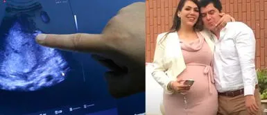 Ginecólogo hizo fuerte acusación tras ver radiografías. Médico que asistió a Gabriela Sevilla revela lo que vio en las ecografías