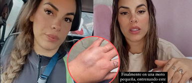 Aída Martínez sufre por caída de moto Aída Martínez sufre por caída de moto