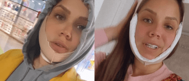 Andrea San Martín comparte detalles de sus operaciones Andrea San Martín se somete a RADICAL 'retoquito' para CAMBIAR SU ROSTRO: “No estoy tan hinchada” | VIDEO