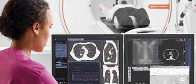 La Tomografía, sin duda, mejora la experiencia del paciente reduciendo los riesgos Avances tecnológicos contribuyen con diagnósticos en el tratamiento de cáncer de pulmón