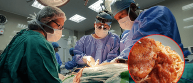 Este inesperado caso sucedióen Estados Unidos. Joven de 19 años pierde sus piernas luego de comer restos de comida del día anterior