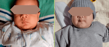 El pequeño necesita pronta ayuda para mejorar de salud. Bebé de 6 meses padeció 5 ANEURISMAS y requiere urgente 50.000 soles cada año para apoyo médico | VIDEO