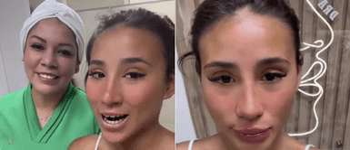 Samahara Lobatón se hace nuevos ‘retoquitos’ en el rostro: “Amé mi rinomodelación y labios” | VIDEO Samahara Lobatón se hace nuevos ‘retoquitos’ en el rostro: “Amé mi rinomodelación y labios” | VIDEO
