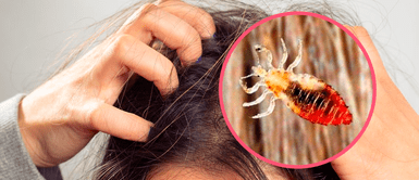 Soñar con piojos: ¿Qué significa este sueño? Conoce todo lo que te quiere decir Soñar con piojos: ¿Qué significa este sueño? Conoce todo lo que te quiere decir