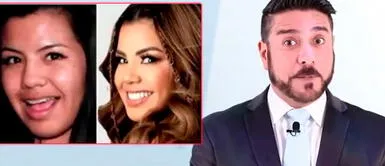 estrella torres: la exintegrante de corazón serrano impacta a cirujano con su antes y después Estrella Torres sorprende a cirujano con su 'antes y después': “Era bastante abandonadita”