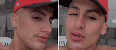 Elías Montalvo reaparece con nuevo 'retoquito' y se defiende de burlas: “he recibido tanto hate” Elías Montalvo reaparece con nuevo 'retoquito' y se defiende de burlas: “he recibido tanto hate”