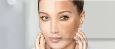 verano 2023: evita mancharte la piel por el sol Verano 2023: Evita mancharte la piel con los rayos de sol siguiendo estos tips