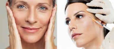 Botox cara Botox en el rostro: Mitos sobre el famoso tratamiento que reduce las arrugas y líneas de expresión