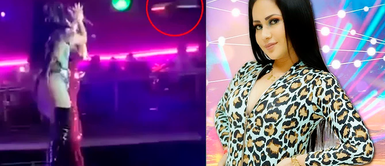 Cantante de Explosión de Iquitos sufre accidente: Drone se quedó atrapado en su cabellera Explosión de Iquitos: Las impactantes imágenes del drone que quedó atrapado en cabello de cantante