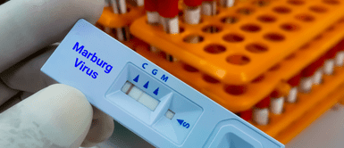 Conoce los síntomas del virus de Marburg. Reportan nueve fallecidos en Guinea Ecuatorial tras primer brote del virus de Marburgo