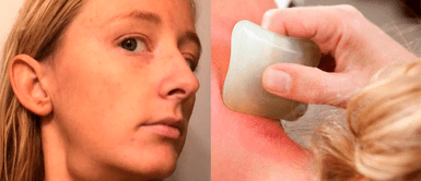 Joven con cáncer terminal Joven descubre que tenía cáncer en etapa 4 tras intentar una rutina de belleza de TikTok