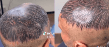 El hombre encontró la solución de sus problemas. Hombre se tatúa falso cabello en la cabeza y usuarios reaccionan: "Sin miedo al éxito"