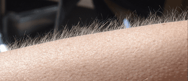 Piel de gallina ¿Por qué se me pone la piel de gallina sin ninguna razón?