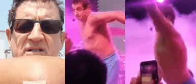 ¿Cómo se encuentra Sergio Galliani tras sufrir caída en show? Sergio Galliani revela cuál es su estado de salud tras sufrir aparatosa caída al lanzarse sobre fans en show