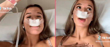 Tiktoker se hizo la rinoplastia y asegura que fue para que sus hijos “nazcan con linda nariz” Tiktoker se hizo la rinoplastia y asegura que fue para que sus hijos “nazcan con linda nariz”