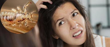 Mujer con picazón de piojo ¿Qué significa soñar con piojos? Descubre el mensaje oculto de este inquietante sueño