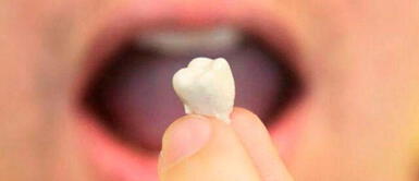 Diente caído ¿Qué significa soñar que se te caen los dientes?