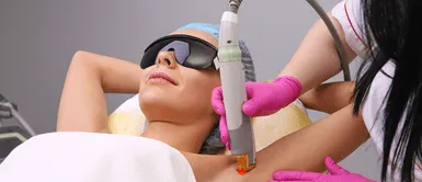 Blanqueamiento de axilas con láser. ¡Di adiós a las axilas oscuras! 5 tratamientos estéticos que necesitas probar