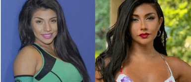 Diana Sánchez hace revelación sobre Combate Diana Sánchez: Modelo revela que "Combate" buscó pagarle un aumento de busto