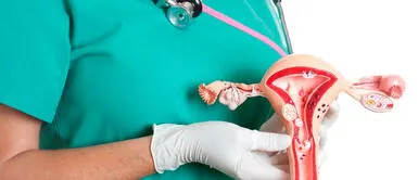 Los virus del papiloma humano (VPH) son un grupo de virus que pueden causar cáncer Tres cosas que debes conocer del Virus del Papiloma Humano en la mujer