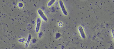 Los riesgos son probablemente bajos. Nubes transportan bacterias resistentes a los antibióticos, según estudio