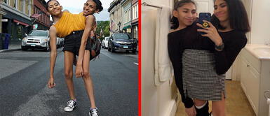 Carmen y Lupita, las siamesas TikTokers más famosas de Latinoamérica Carmen y Lupita: Conoce cómo es la vida diaria de las siamesas TikTokers más famosas de Latinoamérica