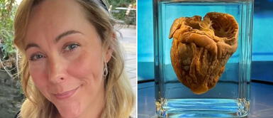 Mujer descubre que su corazón se encontraba en un museo: decide visitarlo tras 16 años de no tenerlo Mujer descubre que su corazón se encontraba en un museo: decide visitarlo tras 16 años de no tenerlo