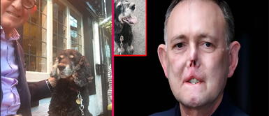 Jaco Nel y la vez que casi pierde la vida debido al amor de su perro Doctor pierde sus piernas, dedos y parte de su cara tras ser lamido por su pequeño perro