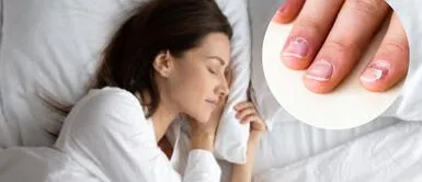 Soñarlo podría estar relacionado a algo negativo ¿Qué significa soñar que se te caen las uñas? Mira el mensaje detrás de este sueño