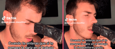 Hombre se entera que si se rompe la nariz en el trabajo la rinoplastia es gratis y saca un martillo Hombre se entera que si se rompe la nariz en el trabajo la rinoplastia es gratis y saca un martillo