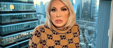 La presentadora Laura Bozzo sufrió fuerte caída Laura Bozzo sufre fuerte caída y muestra cómo quedó su rostro tras accidente: "Tuve una crisis de ansiedad"