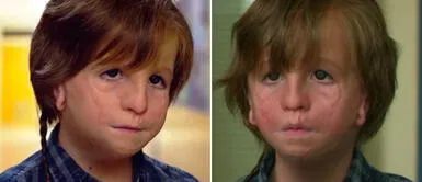 La película titulada 'Wonder', o 'Extraordinario' en español, generó un gran impacto a nivel internacional. (Foto: referencial) Así luce actualmente el niño abandonado por su rostro deforme: su historia conmovió al mundo