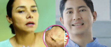 Maricielo lamenta haberse sometido a operación con el doctor Fong El angustiante lamento de Maricielo Effio: "Me arrepiento en el alma de haber confiado en este tipo"