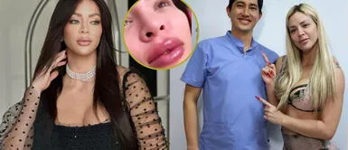 Sheyla Rojas se operó con el Dr. Fong. Sheyla Rojas se operó con el Dr. Fong y terminó con parálisis en el rostro, ¿qué sucedió?