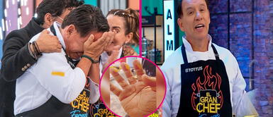 Ricardo Rondón, ganador de la primera temporada en 'el Gran Chef: famosos' Horror en la cocina: Ricardo Rondón enseña las espeluznantes heridas en los dedos que sufrió en la final de ‘El Gran Chef’
