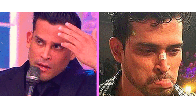 Christian Domínguez es troleado por operación en su nariz. Christian Domínguez es troleado por operación en su nariz, pero él aclara: “No fue estético”