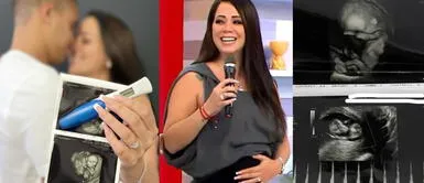 Melissa Klug podría haber revelado el sexo de su bebé. Melissa Klug muestra sus primeras ecografías y usuarias se dieron cuenta del sexo del bebé