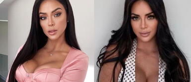 Internautas comparan a Sheyla Rojas con Michael Jackson. Sheyla Rojas sorprende al mostrar cómo quedó su nariz tras operación