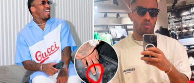 Jefferson Farfán padece de hongos en sus uñas de la mano ¿Por qué Jefferson Farfán tiene hongos en sus uñas, si cuenta una fortuna de 60 millones de dólares?