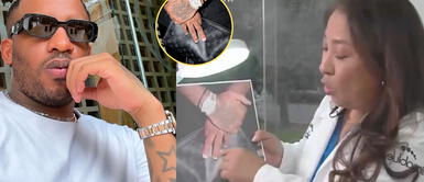 Especialista analiza la mano y uñas de Jefferson Farfán. Podóloga revela el real problema en las uñas de Jefferson Farfán: “Ha ido saltando a otros dedos”