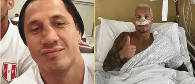 Gianluca Lapadula y su operación de nariz tras dolencias. Gianluca Lapadula se somete a cirugía de nariz y revela su temor a una nueva fractura