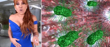 Magaly Medina revela detalles de su mal llamado SIBO. La impactante confesión de Magaly Medina: Su lucha contra una extraña enfermedad que inflama su vientre