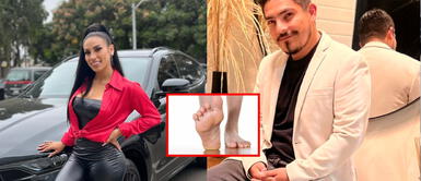 Alisson lo cuenta todo. ¿Qué es ese olor? Alisson Pastor revela el secreto más vergonzoso de Erick Elera